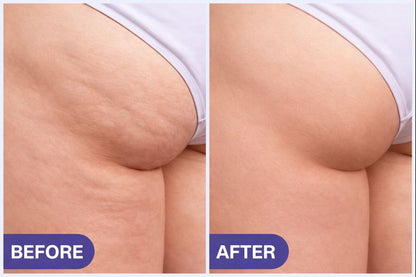 DermaLift+ Hip & Thigh Tightening Cream